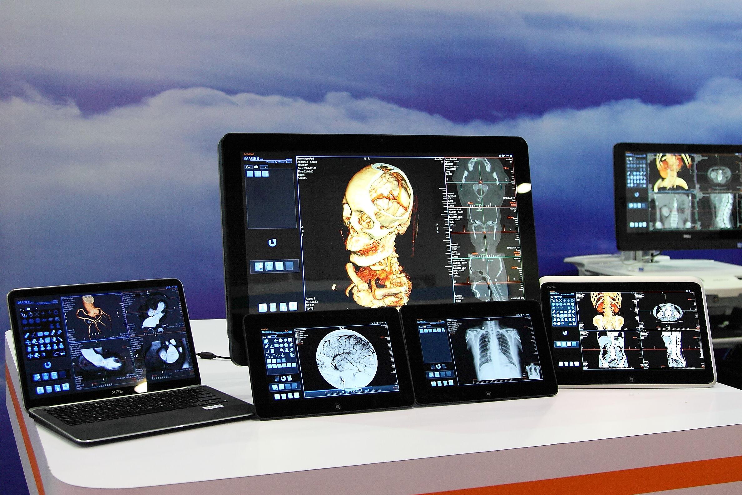 醫療行業(yè)：云引擎顛覆傳統PACS