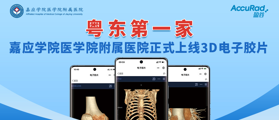 “手機掃一掃，云端影像隨時(shí)看”！盈谷網(wǎng)絡(luò )助力嘉應學(xué)院醫學(xué)院附屬醫院3D電子膠片正式上線(xiàn)！